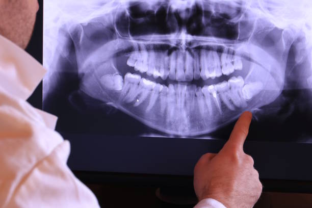 Best Emergency Treatment for Toothache in Mantachie, MS