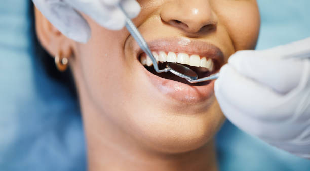 Best Emergency Wisdom Teeth Removal in Mantachie, MS