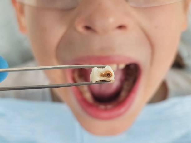 Best Same-Day Emergency Dentist in Mantachie, MS